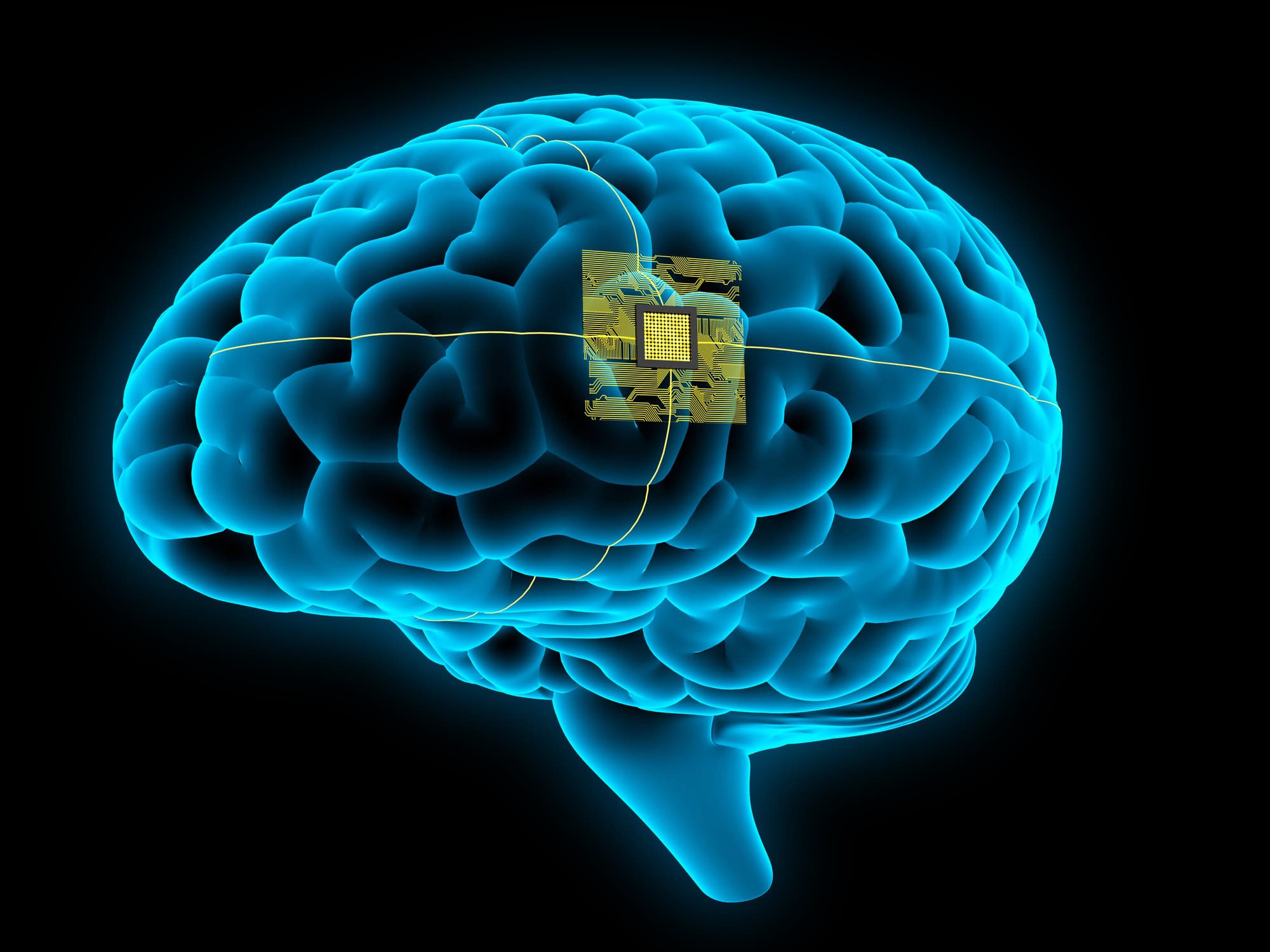 neuralink